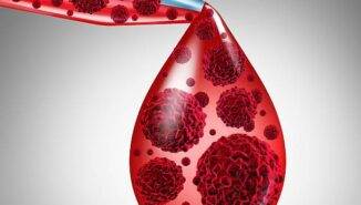 Akut lenfoblastik lösemi