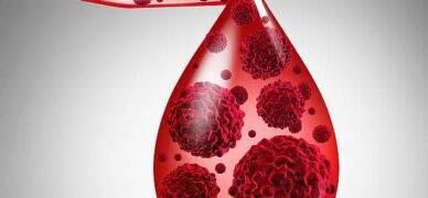 Akut lenfoblastik lösemi nedir