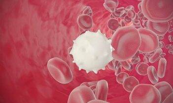 Akut miyeloid lösemi