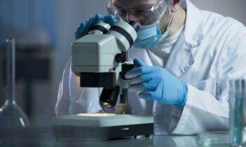 Akut miyeloid lösemi tanısı