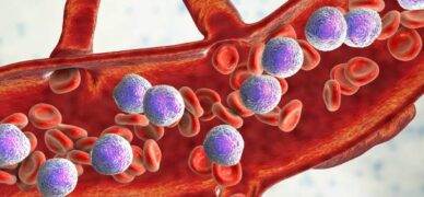 Akut promyelositik lösemi