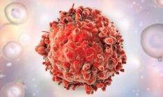 Kronik miyeloid lösemi safhaları