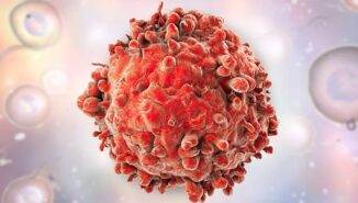 Kronik miyeloid lösemi safhaları