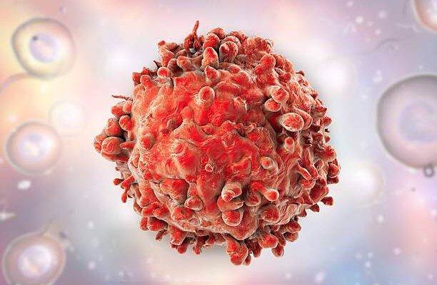 Kronik miyeloid lösemi safhaları