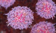 Kronik miyeloid lösemi tanısı