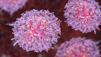 Kronik miyeloid lösemi tanısı