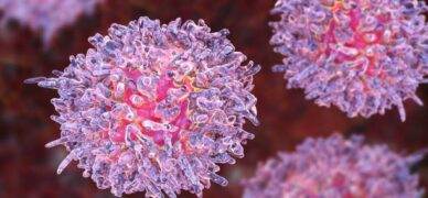 Kronik miyeloid lösemi tanısı