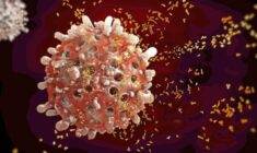 Kronik miyeloid lösemi tedavisi