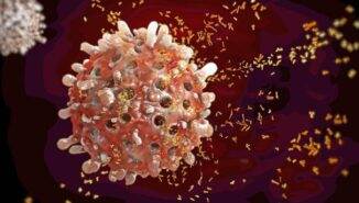 Kronik miyeloid lösemi tedavisi