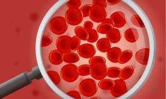 Eritrosit düşüklüğü nedenleri