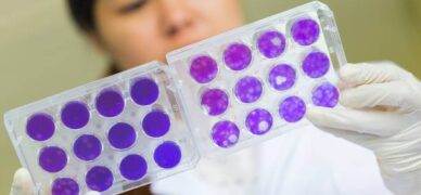 Nötrofil yüksekliği tedavisi