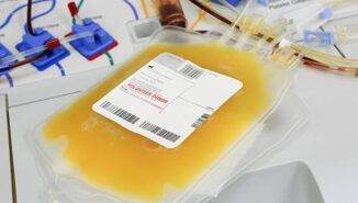 Trombosit bağışı