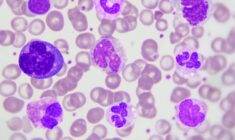 Bazofil düşüklüğü