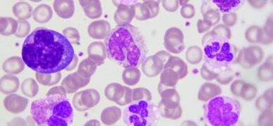 Bazofil düşüklüğü