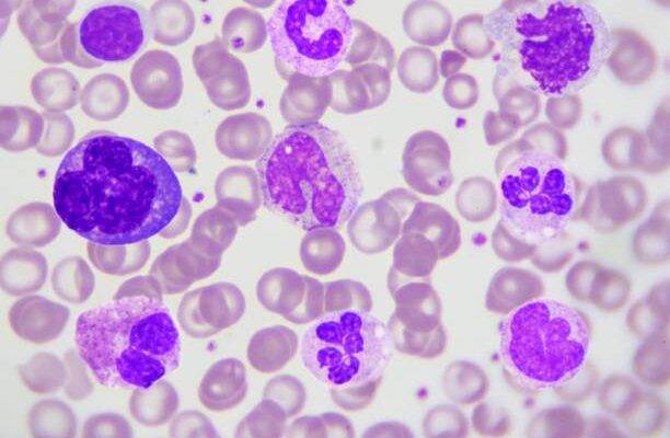 Bazofil düşüklüğü