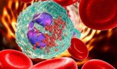 Eozinofil düşüklüğü