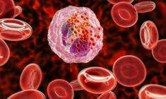 Eozinofil yüksekliği