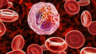 Eozinofil yüksekliği