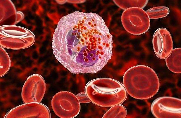 Eozinofil yüksekliği