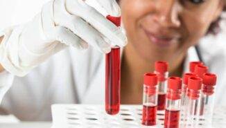 Hemoglobin yüksekliği