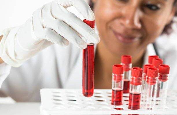 Hemoglobin yüksekliği